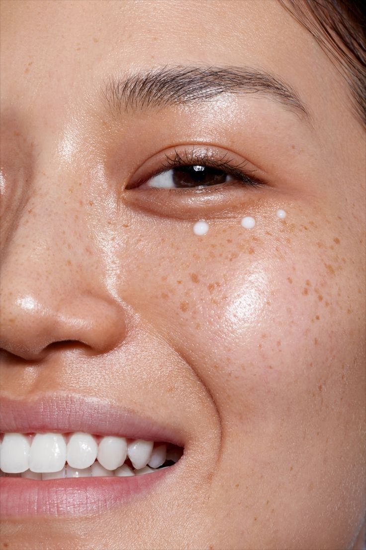 Crème yeux Madagascar Centella Probio-Cica Bakuchiol SKIN1004, points de crème sous l’œil d’une mannequin souriante